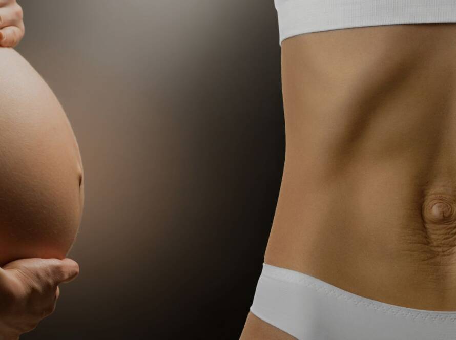 Pregnancy aches and pains, diastasis recti and postnatal rehabilitation